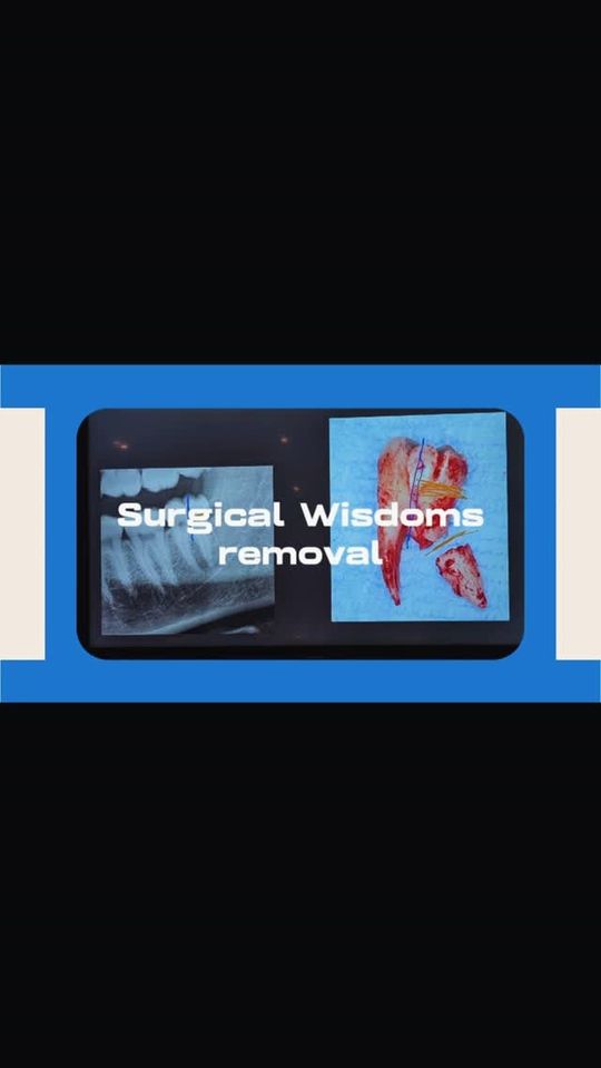 Cover image of a Y3 Smiles Dental Instagram video